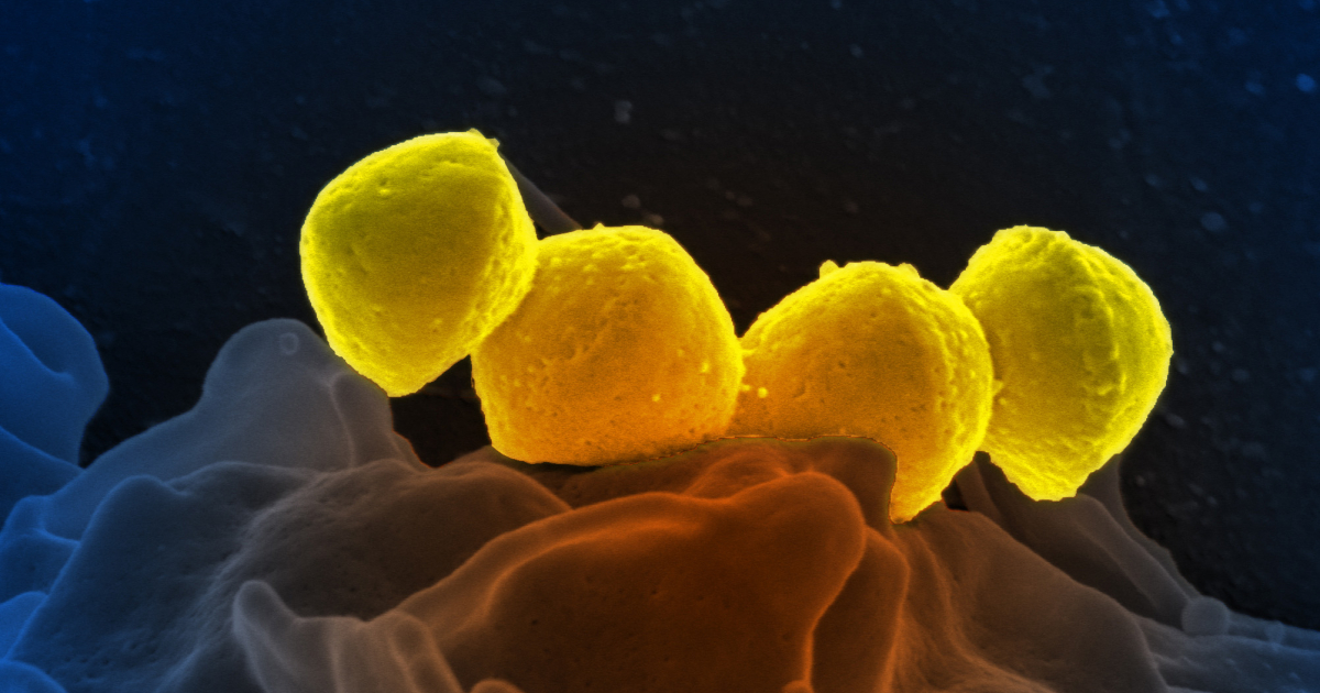 Identification des pathogènes par spectrométrie de masse de type MALDITOF en Identification des pathogènes par spectrométrie de masse de type MALDITOF en